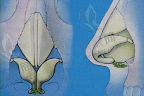 合肥壹加壹整形医院热门项目价格与优势分析
