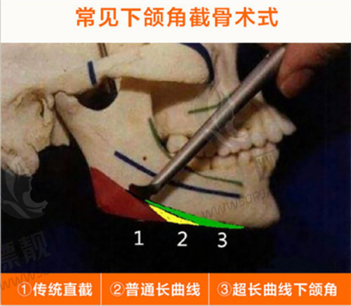 把问诊变成美学课堂