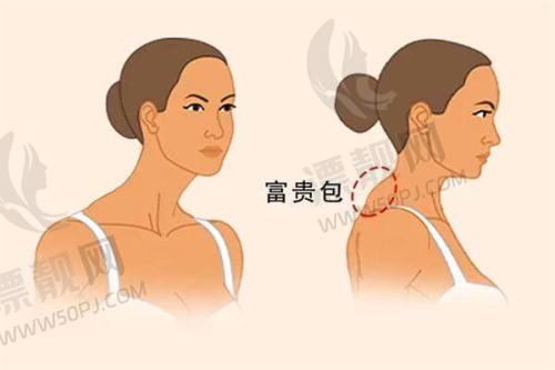 郑州科大医院是正规的吗？口碑、擅长领域及是否私立医院全揭秘
