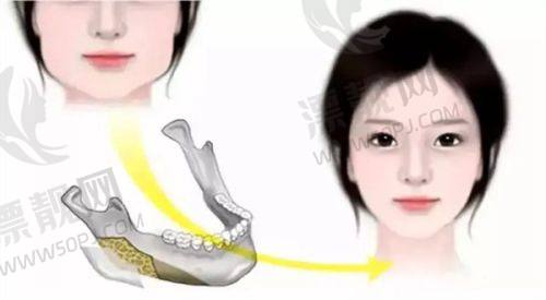 沈阳杏林整形医院项目价格表大揭秘！割双眼皮、纹眉等热门项目最新收费看这里