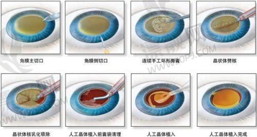 至佳注射时间,你知道吗?
