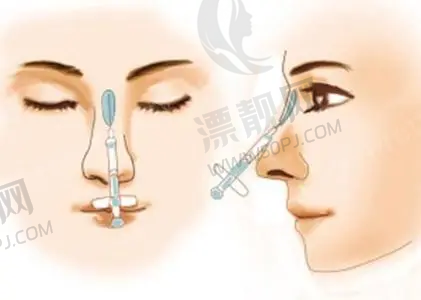 适用部位大比拼:轻薄针和溶脂针适合打在哪里?