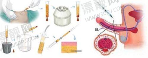 如何选择适合自己的医院和医生
