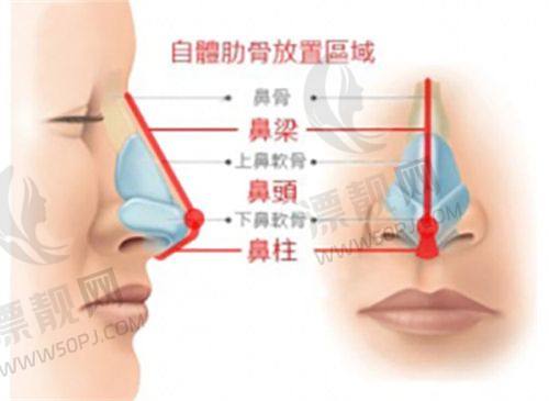 成效特点大揭秘:轻薄针和溶脂针能带来什么成效?