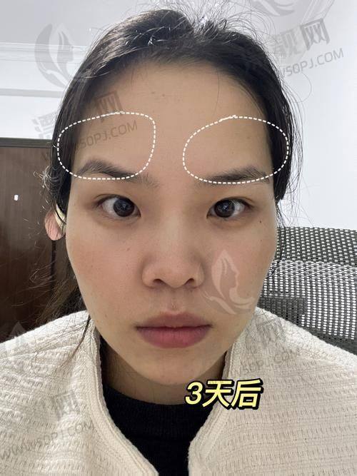 上海幼态脸打造哪个医生好？这份TOP10榜单别错过！