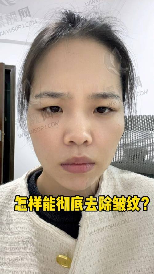 10. 陈晓琳 - 上海华颜医疗美容