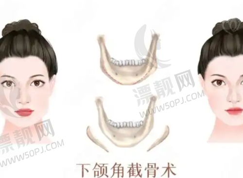 北京奥尔贝德赵军舰医生抽脂价格表揭秘！2025 最新价目及赵军舰吸脂技术全解析