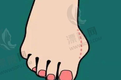 术后管理:贴心呵护每一步