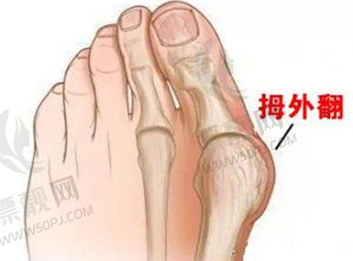 北京陈凤超主任都去哪儿坐诊了？陈凤超医生修复双眼皮及2025年坐诊安排大揭秘