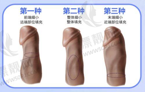 费用及注意事项