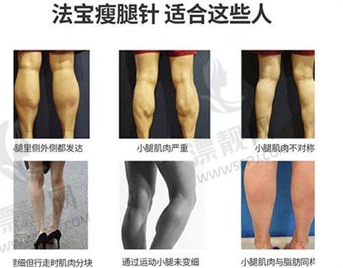 2. 兰州新禾植发中 心