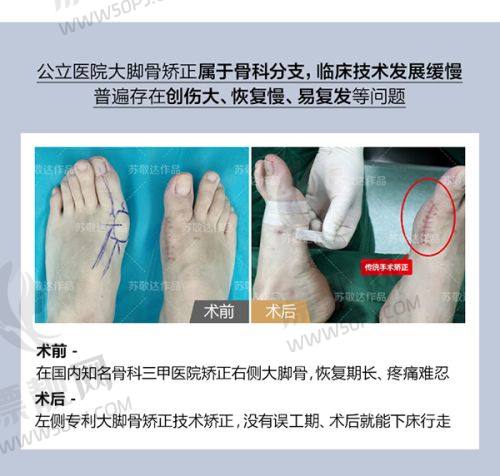 北京画美医院徐学东医生鼻综合收费32800元起，审美自然显精致