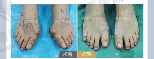  北京画美医院马群医生鼻修复收费8800元起，成功率超高