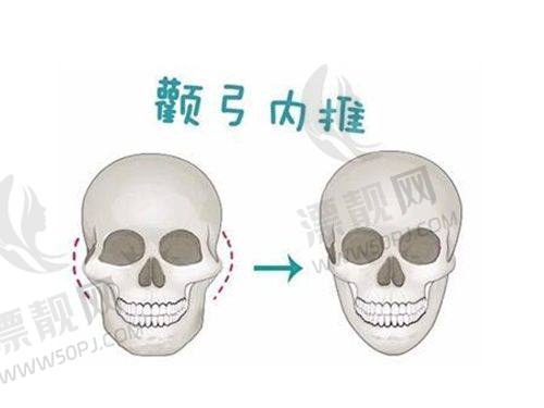 见证6000单位植发的惊人成效