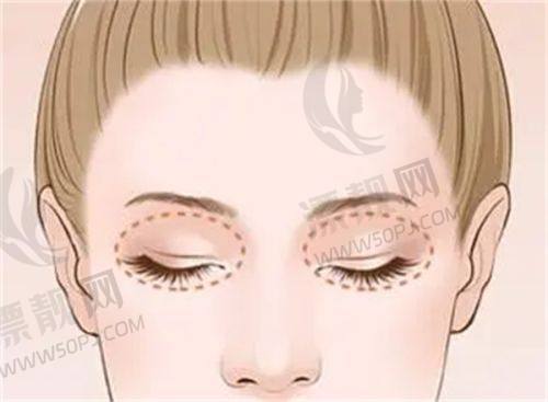 三、选择医院的关键秘籍
