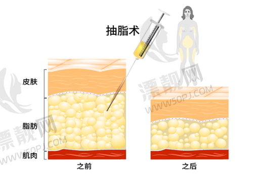 石家庄正规整形医院排名榜前十名（2025最新版）：雅芳亚、蓝山、美莱领衔！