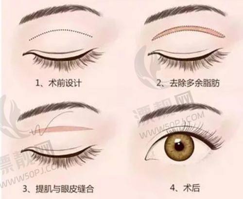 沈阳友谊整形医院怎么样？官网、简介、位置全揭秘，看它为何备受青睐！
