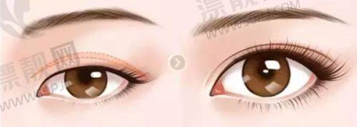济南俏嘉丽整形医院的其他医美项目