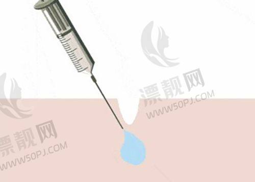 韩国水滴鼻手术的费用及注意事项