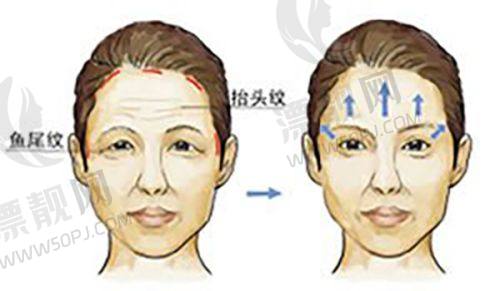 北京京城皮肤医院医疗美容王驰医生胸部综合整形29800元起，动态美学设计优