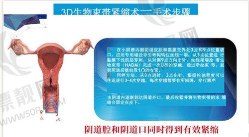 三、高难度修复大师