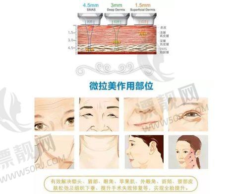 【那些惊艳上海的修复实例】