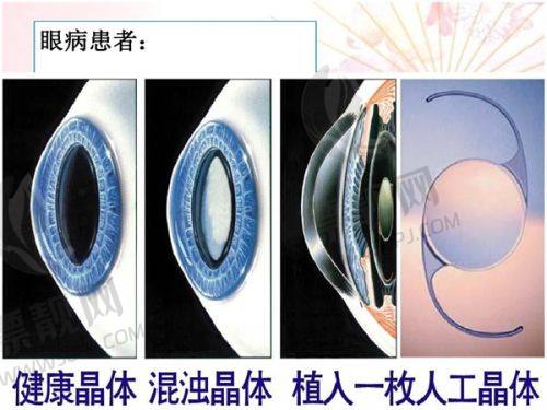 TOP2:ID整形医院