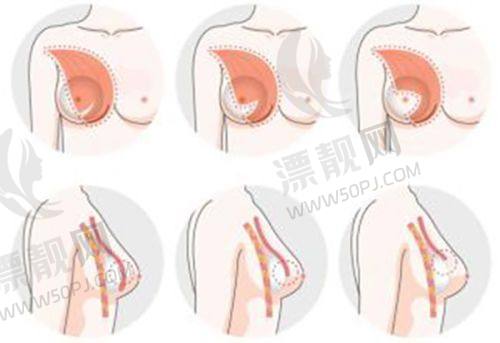 选择济南俏嘉丽整形医院的理由
