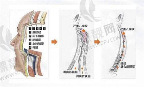 成都治疗疤痕疙瘩具有影响力医院排名