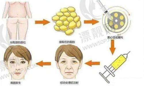 馒化修复的关键——医生的选择