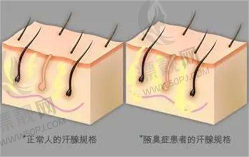 成都治疗疤痕疙瘩最权威的医院排名：四川大学华西医院蒋献、成都疤研疤痕研究院庞和平、成都大学附属医院邢燕