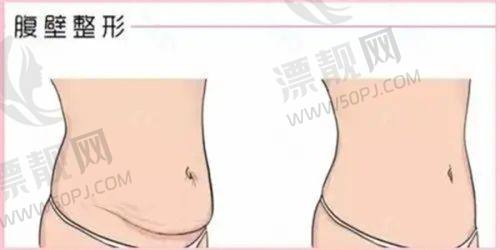 顾客真实实例分享