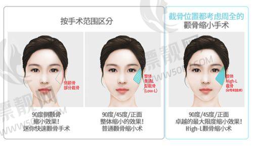 苏州维多利亚整形医院整形成效究竟怎么样?