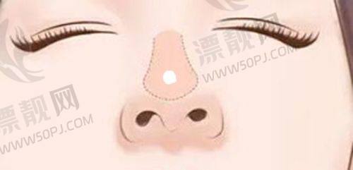实际实例见证高性价比