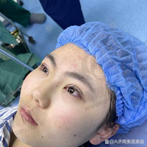 南京美贝尔美容医院介绍：是正规医美机构院内都是有实力的好医生收费亲民