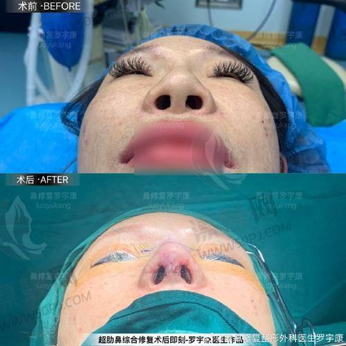 4. 惠州鹏爱医疗美容医院