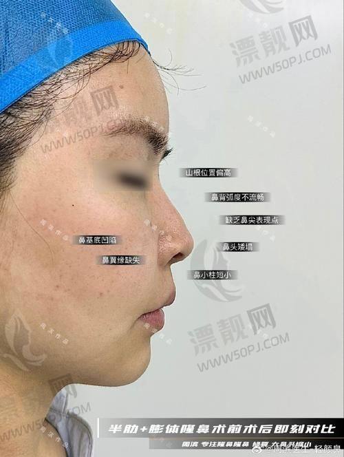 10. 惠州伊美医疗美容门诊