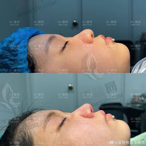 3. 惠州韩妃医疗美容医院