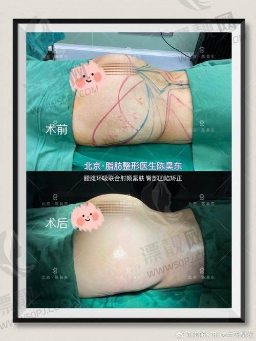 真实实例揭秘：术中术后都靠谱