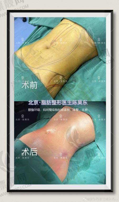 价格方面透明不套路，具体项目表明细来了