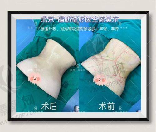 术后修复与管理：细节管理决定更终成效