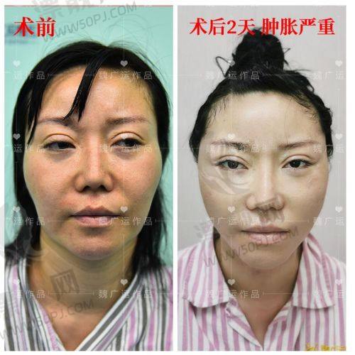 TOP4 河南中医药大学第一附属医院整形外科