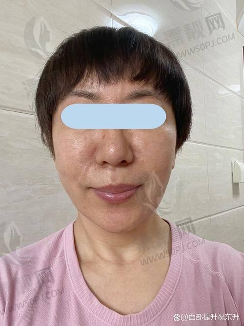 TOP5 郑州大学第二附属医院整形美容科
