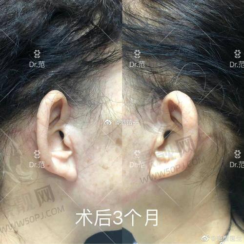TOP9 郑州壹加壹医美医院