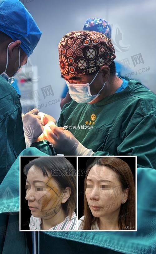 郑州三甲医院做拉皮哪家好？看完郑州拉皮医院排名前十的机构就知道啦