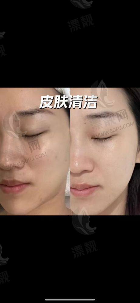 注射美容/微整项目价格一览表