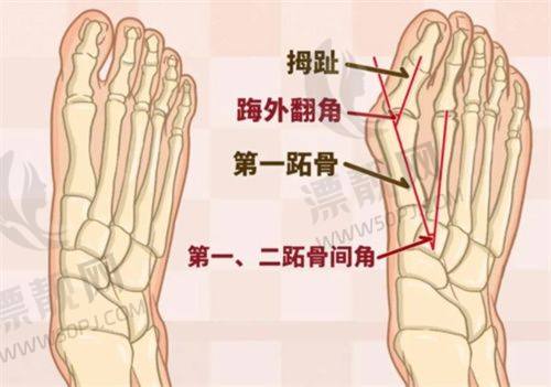 求美者选择建议