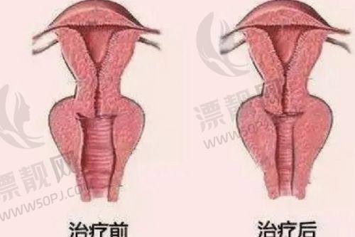 选择建议