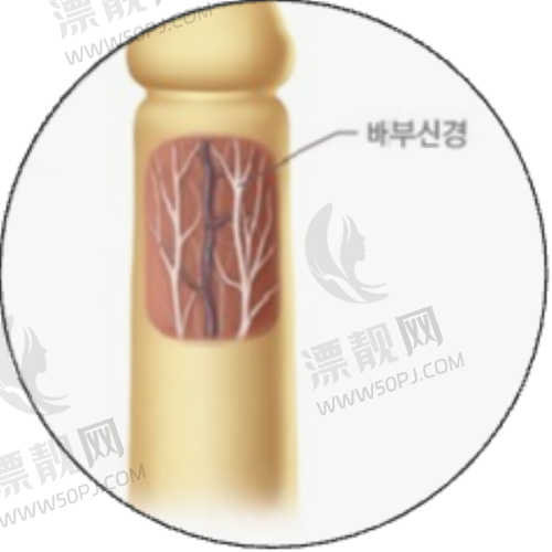 1. 武汉艺星医疗美容医院 - 抽脂界的“科技先锋”
