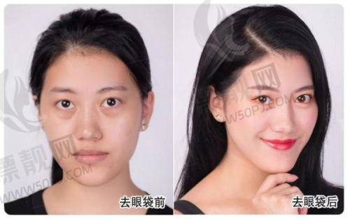 合肥脂肪填充医生TOP3推荐